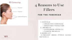 3D Forehead Contour - Skin Perfect Brothers Powered by VLA