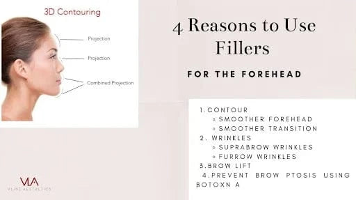 3D Forehead Contour - Skin Perfect Brothers Powered by VLA