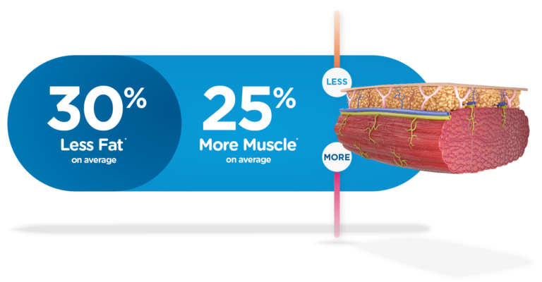 What is EMSCULPT NEO?