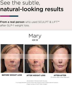 Sculptra - Skin Perfect Brothers Powered by VLA