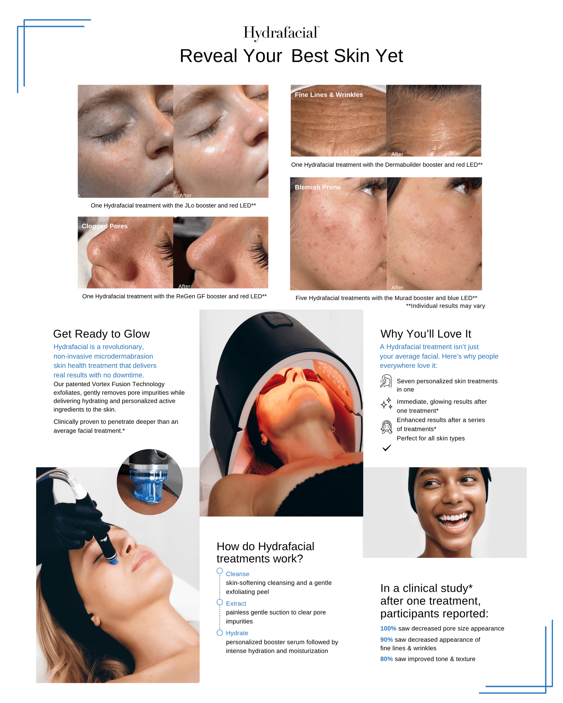Hydrafacial - Skin Perfect Brothers Powered by VLA