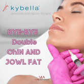 Jowl Fat Removal - Kybella Treatment - Skin Perfect Brothers Powered by VLA