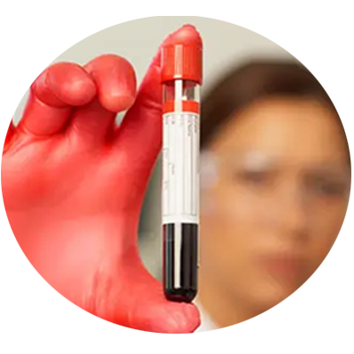 Baseline Labs & Inflammatory Markers
