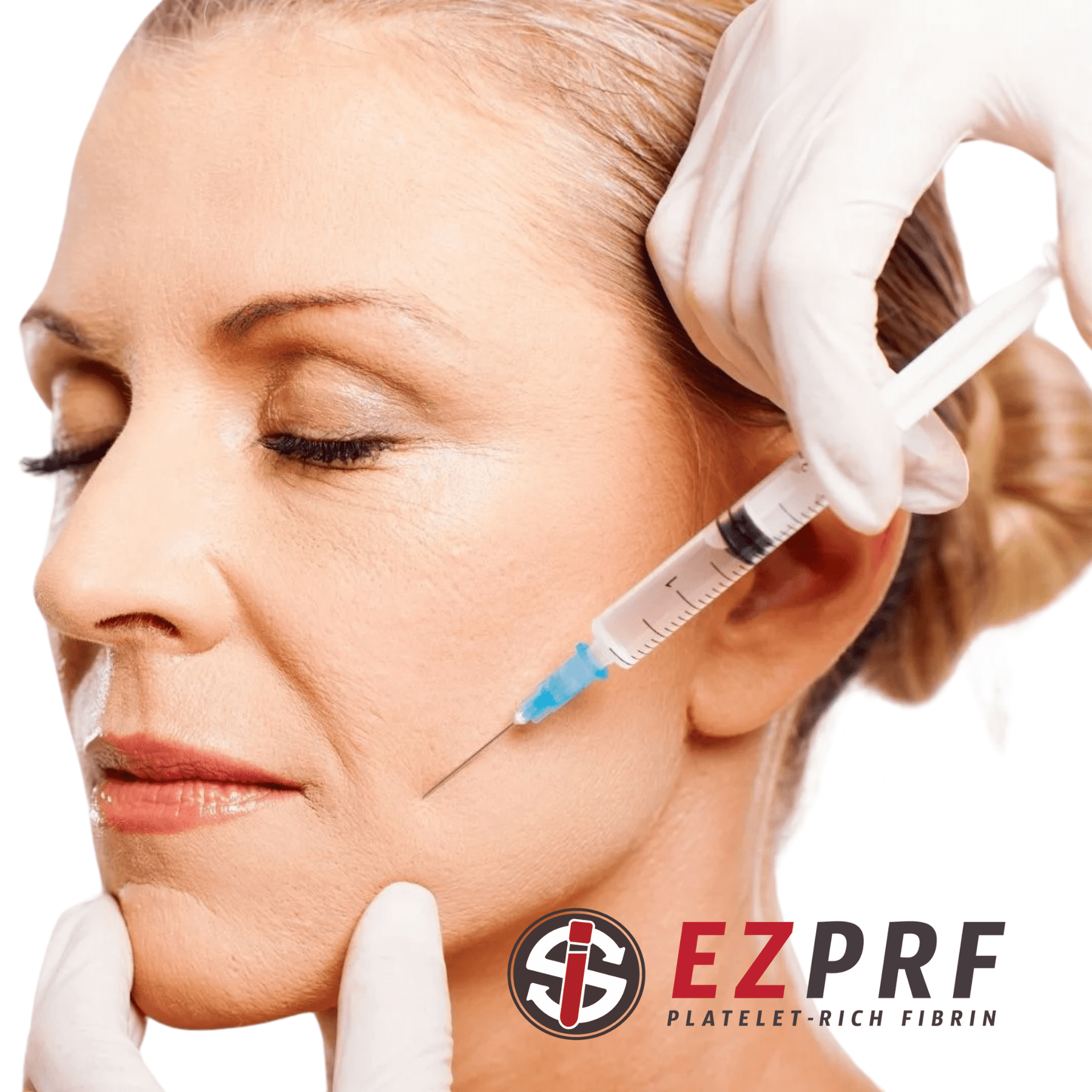 Vampire Eye Treatment - Platelet-Rich Fibrin (PRF) - Skin Perfect Brothers Powered by VLA