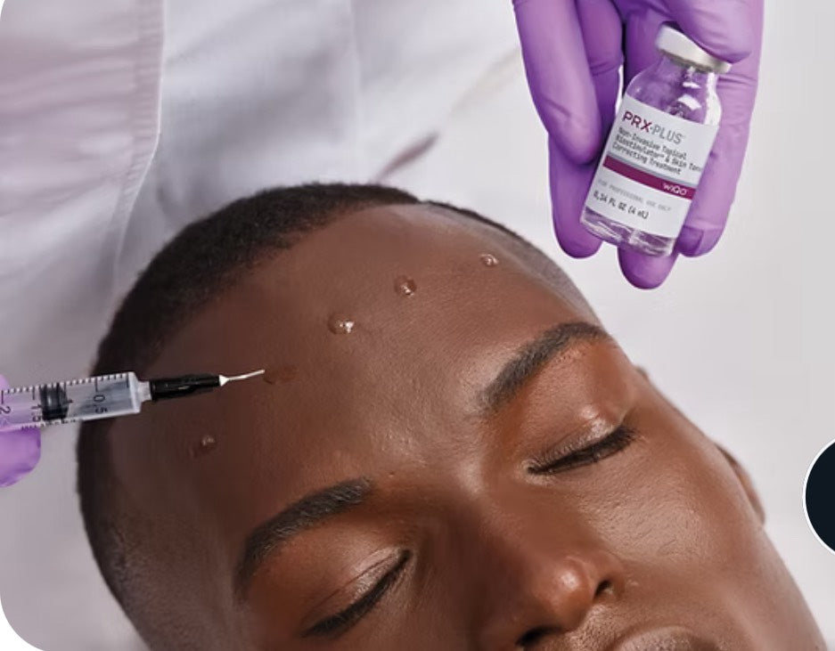 PRX Treatment - Skin Perfect Brothers Powered by VLA