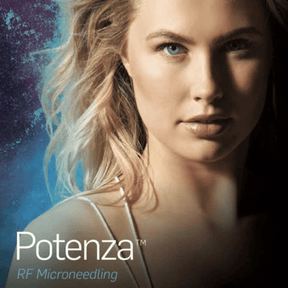 Potenza | RF Microneedling with Exosome - Skin Perfect Brothers Powered by VLA