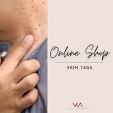 Skin Tags - Skin Perfect Brothers Powered by VLA