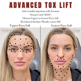 Tox Lift - Skin Perfect Brothers Powered by VLA