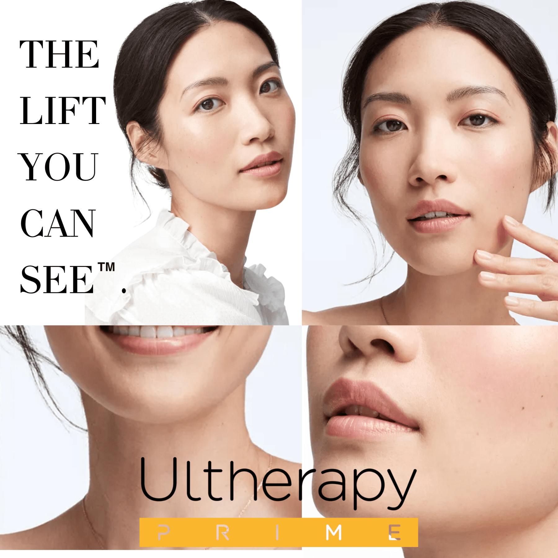 Ultherapy Prime Jawline Lift - Skin Perfect Brothers Powered by VLA