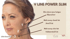 Masseter Injection - Skin Perfect Brothers Powered by VLA