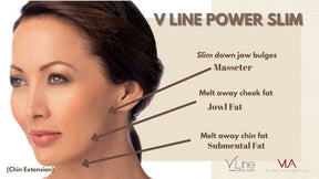 Masseter Injection - Skin Perfect Brothers Powered by VLA