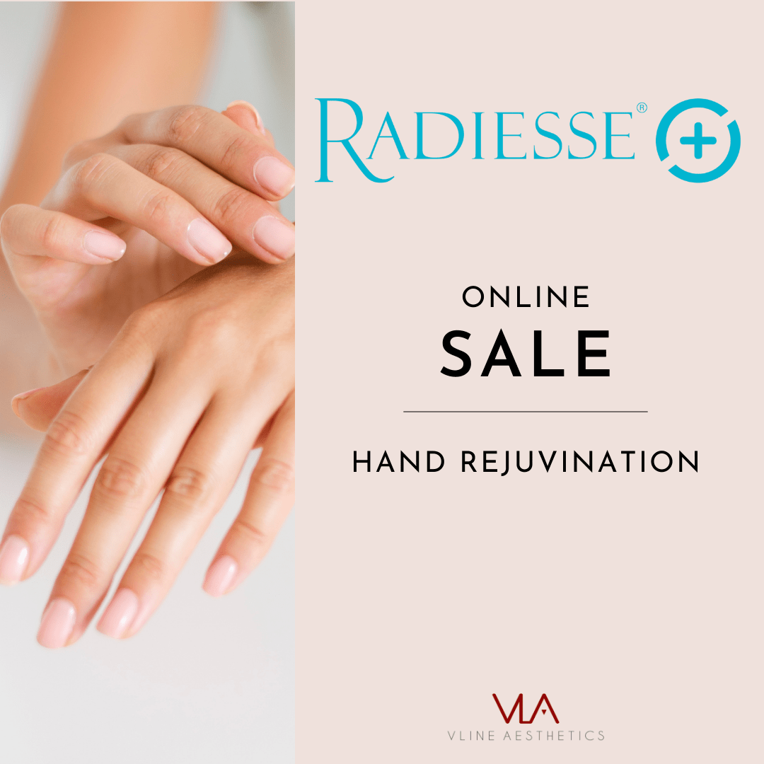 Hand Rejuvenation / 1 Radiesse - Skin Perfect Brothers Powered by VLA