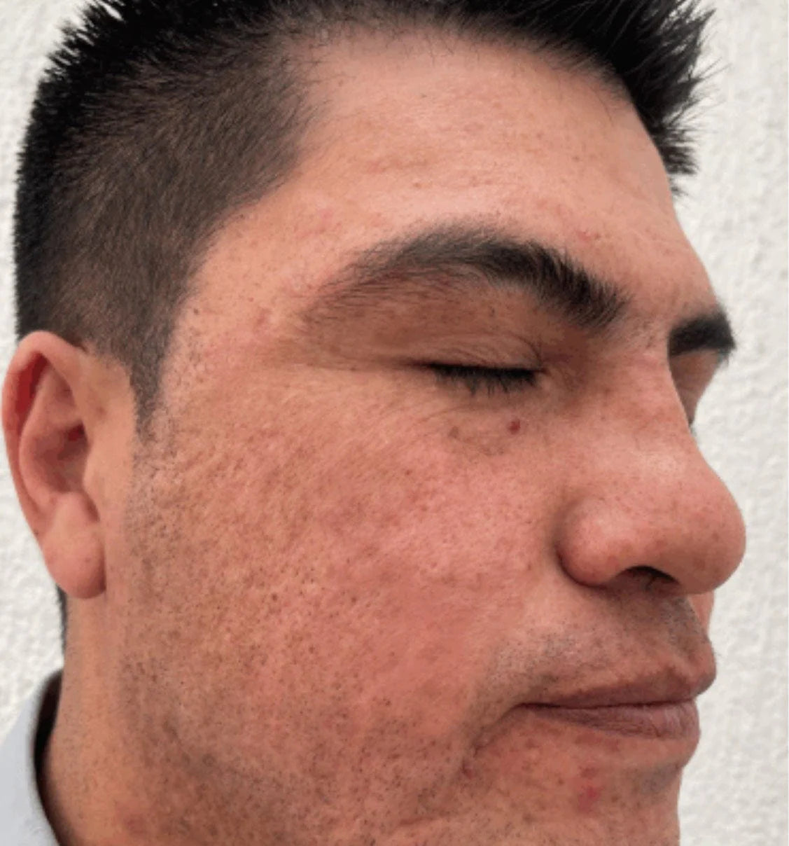 Juvelook