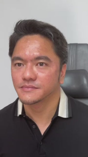 Chin Projection