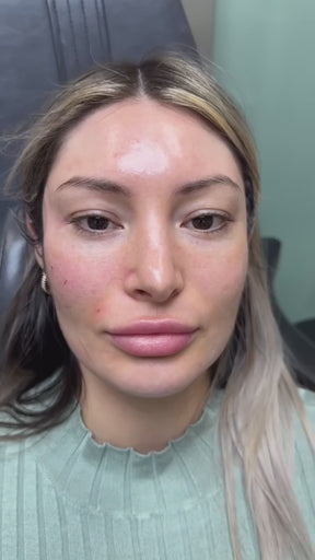 Collagen Lift/Boost