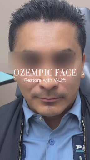 Collagen Lift/Boost