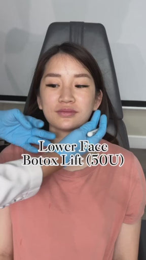 Tox Lift
