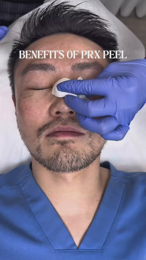 PRX Treatment