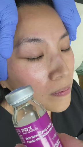 PRX Treatment