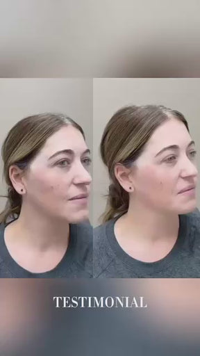 Collagen Lift/Boost