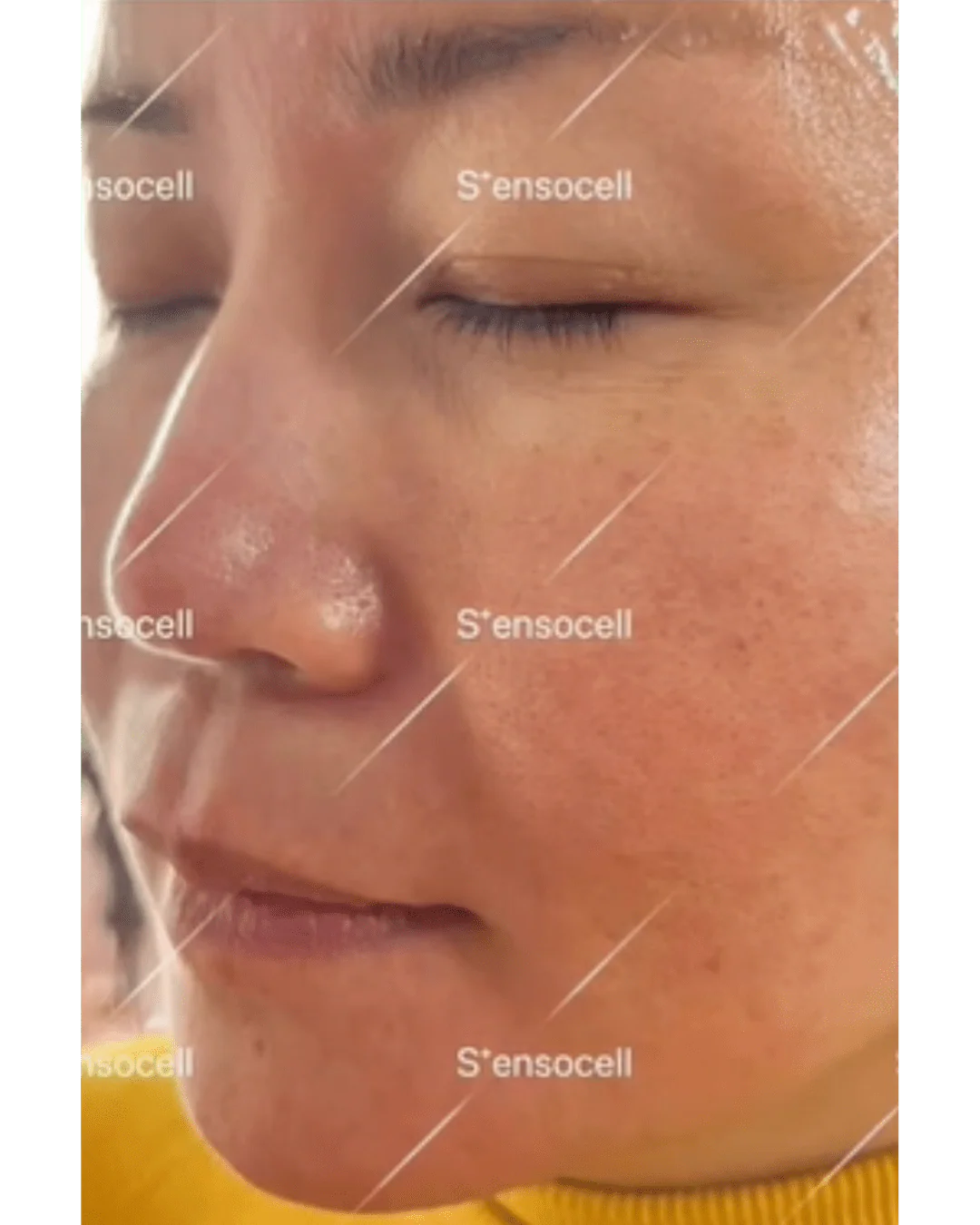 SensocellMD