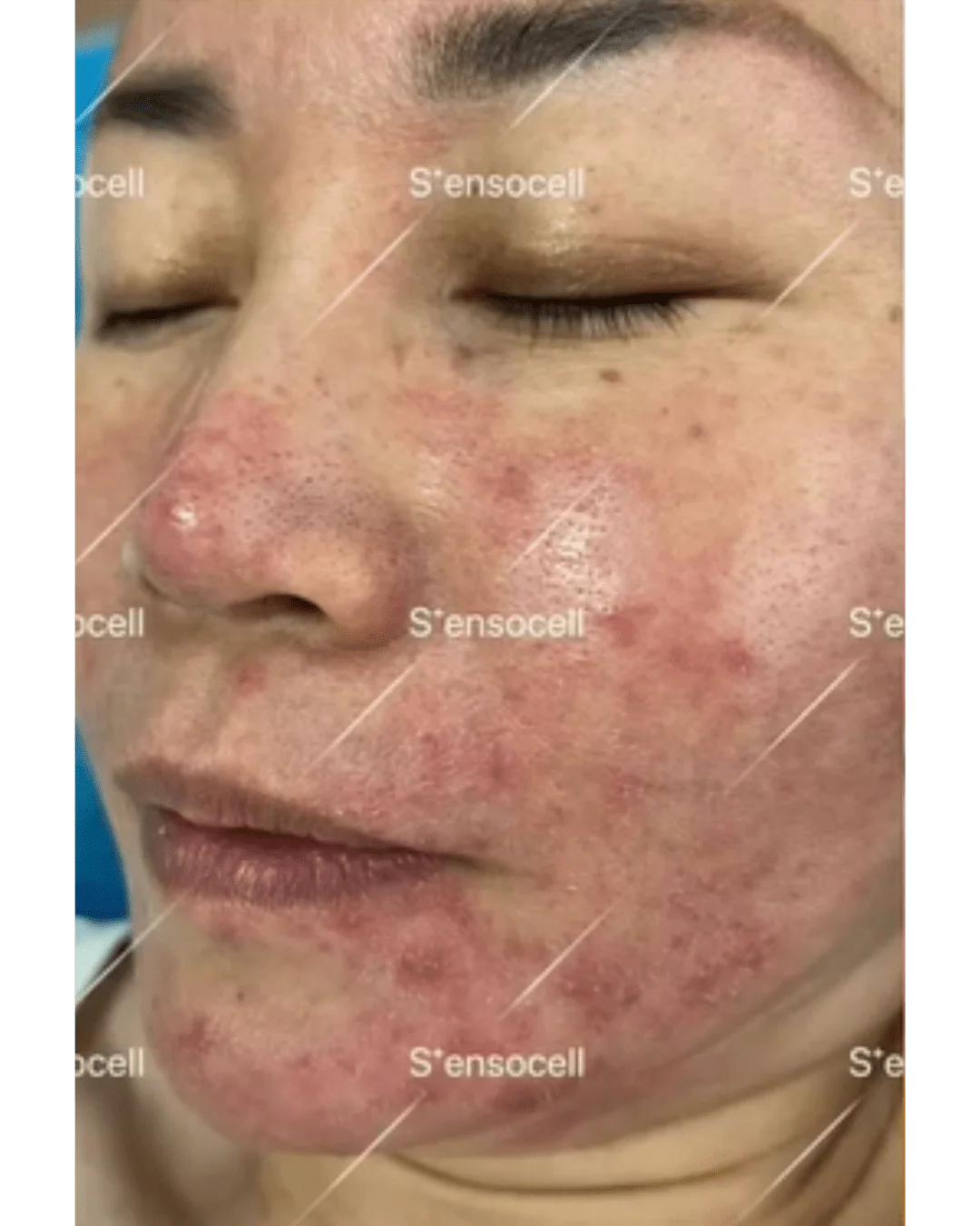 SensocellMD