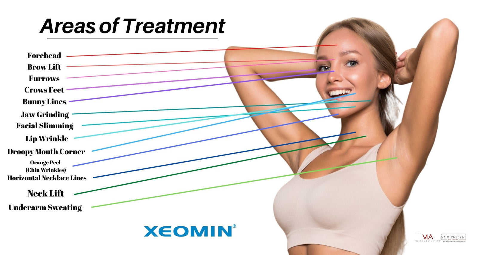 Xeomin injectable treatment areas diagram — forehead, brow, furrows, jaw, lips, neck and more